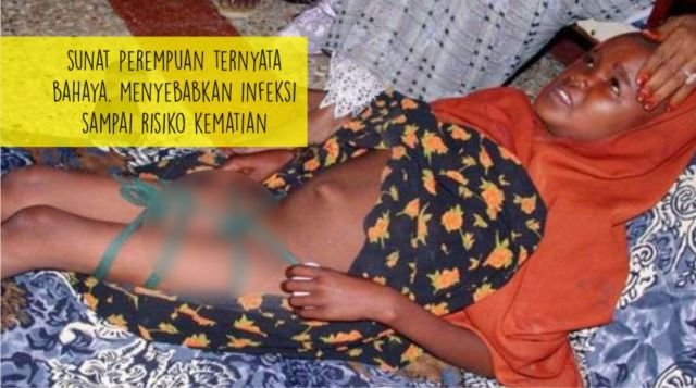 Sunat Perempuan Masih Dilakukan di Beberapa Negara, Termasuk Indonesia. Inilah 9 Faktanya