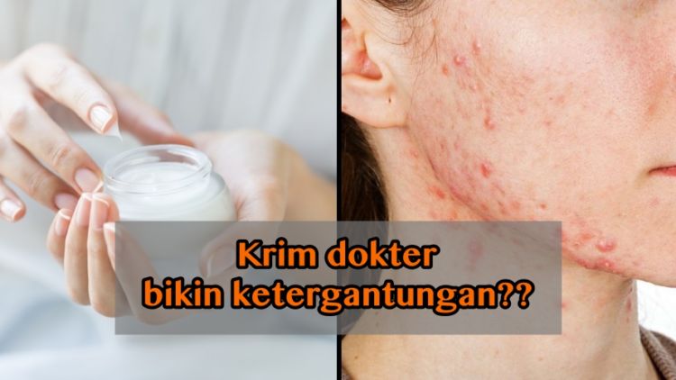 Ketergantungan Krim Dokter? Berikut Penjelasan Ilmiahnya Agar Kamu Tak Menyalahkan Siapa-siapa