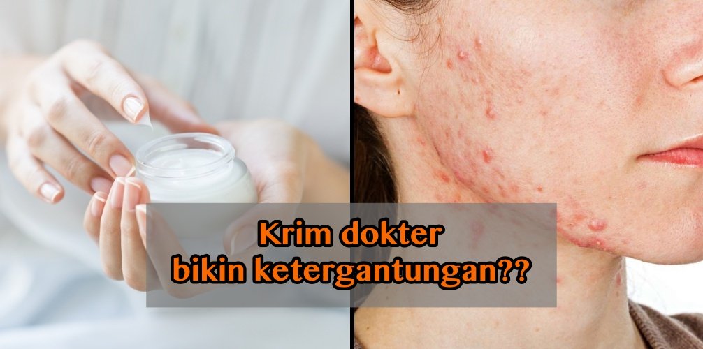 Ketergantungan Krim Dokter? Berikut Penjelasan Ilmiahnya Agar Kamu Tak Menyalahkan Siapa-siapa