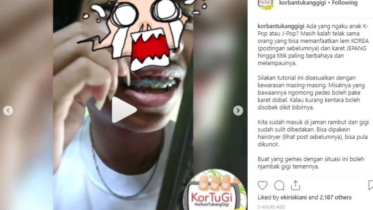 Makin Menjadi, Praktik Pemasangan Behel Pakai Lem Korea Dibongkar Habis Akun @korbantukanggigi