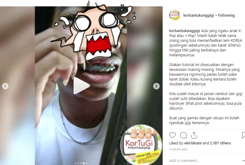 Makin Menjadi, Praktik Pemasangan Behel Pakai Lem Korea Dibongkar Habis Akun @korbantukanggigi