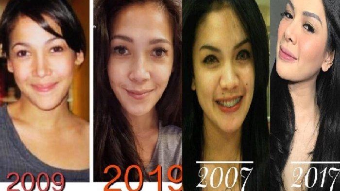 Lagi Viral #10YearsChallenge, Siapa Saja Sih Artis yang Ikut Meramaikannya?