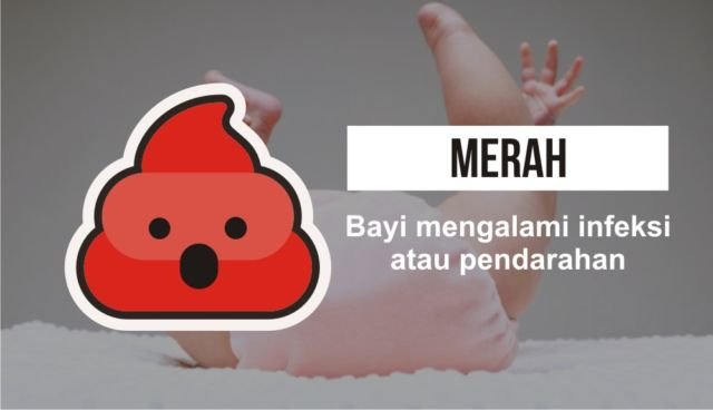 Pintar Mengenal 7 Warna Feses Bayi, Jadi Penanda Kondisi Kesehatan Sang Buah Hati