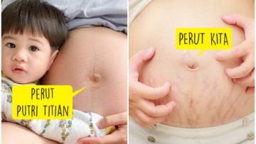 Perut Hamil Putri Titian Bikin Salah Fokus Karena Mulus. Beginilah 5 Cara Hamil Tanpa ‘Stretch Mark’