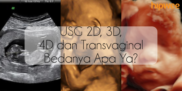 Sama-sama Bisa ‘Mengintip’ Wajah Janin di Perut, Inilah Bedanya USG 2D, 3D, 4D dan Trans Vaginal