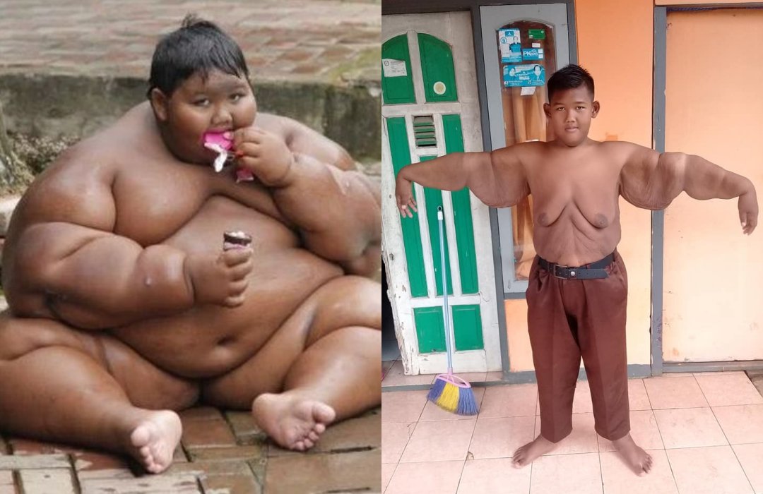 Perjuangan Arya Lawan Obesitas. Berhasil Turunkan Berat Badan, Begini Penampakannya Saat Ini