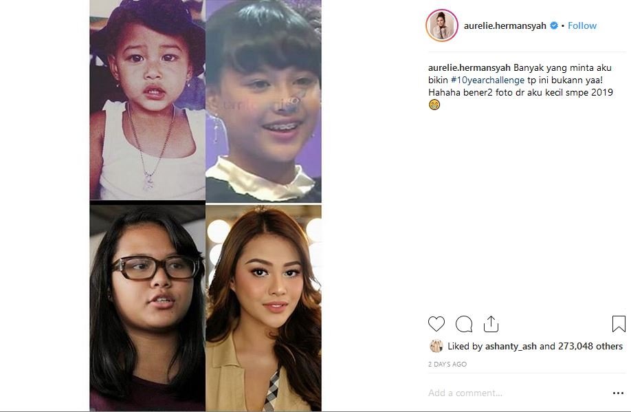 Bukan #10YearsChallenge, Aurel Hermansyah Unggah Foto Transformasi dari Kecil Hingga Sekarang. Manisnya Kebangetan!