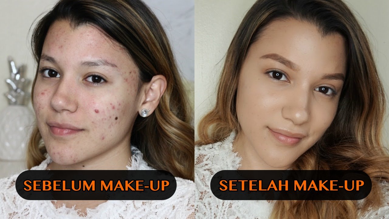 Kumpulan Video Tutorial ‘Acne Makeup’. Segala Macam Jenis Jerawat Bisa Ketutup!