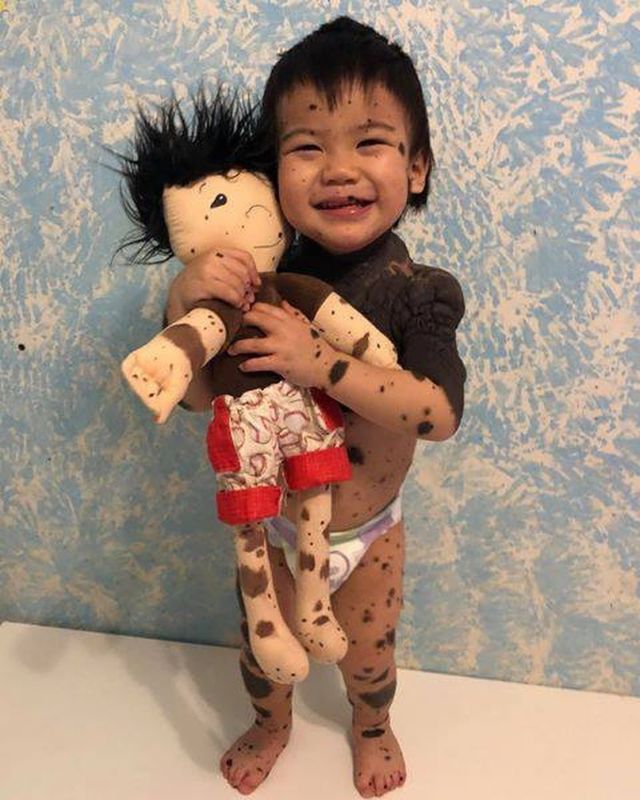 Bikin Terenyuh, 7+ Potret Anak 'Spesial' dan Boneka Berkarakter Mirip Mereka Ini Dibuat untuk Alasan yang Sangat Mulia