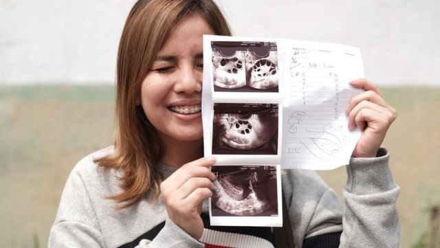 Dear Mama, Ingin Hamil Anak Perempuan? 6 Trik Jitu Ini Layak Dicoba Bersama Suami Tercinta