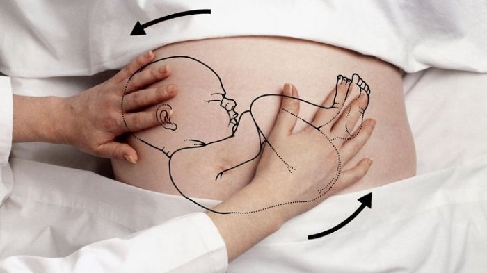 Ibu Hamil Wajib Baca. Inilah 4 Jenis Posisi Bayi dalam Kandungan dan Cara Persalinan Terbaiknya