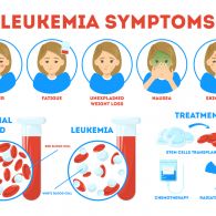 6 Info Tentang Kanker Darah yang Simpang Siur. Kanker Darah = Leukimia?