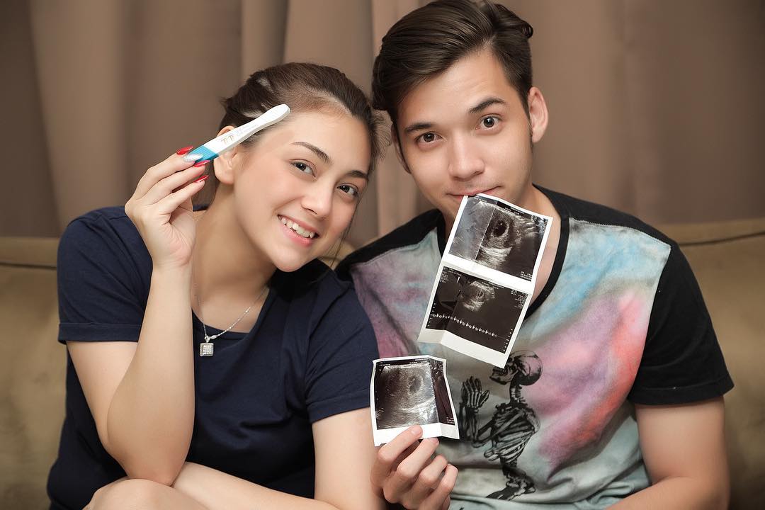 Stefan William dan Celine Evangelista Nantikan Anak ke-2, Publik Deg-degan Nunggu Wajah Bulenya!