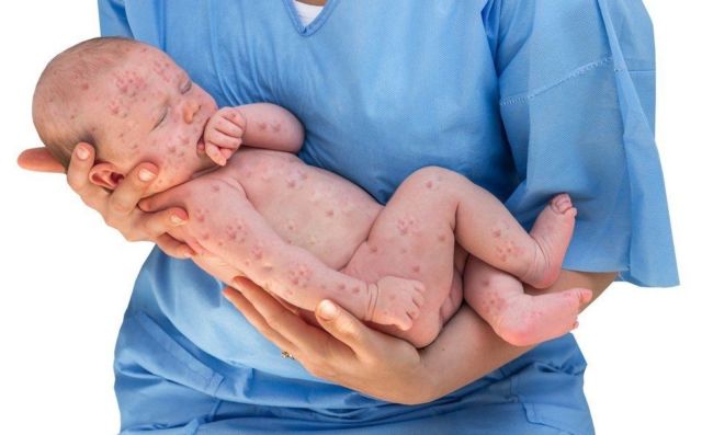 Italia Larang Anak Tanpa Vaksin Masuk Sekolah. Solusi Jitu untuk Orang Tua Bandel Nih