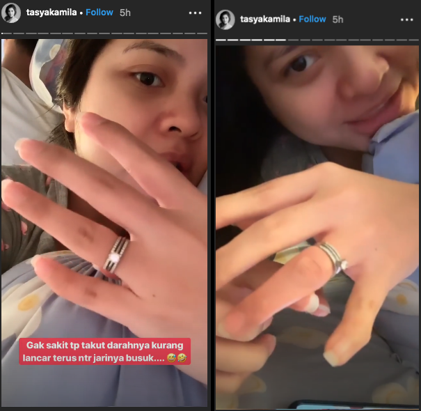 Cincin Nikah Susah Lepas, Tasya Kamila Takut Jarinya Busuk. Sang Suami Jadi Ikutan Panik