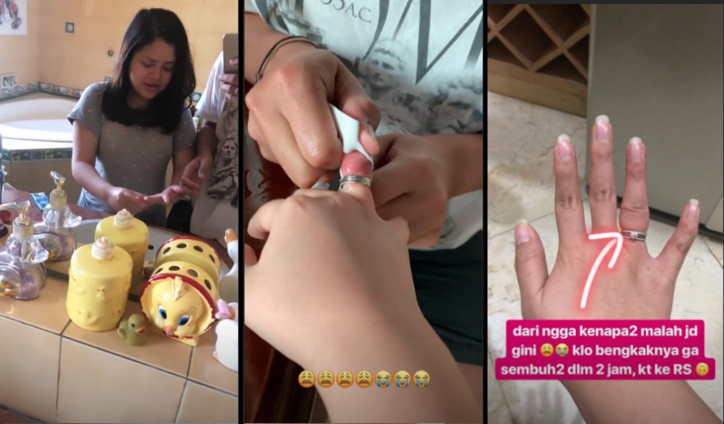 Cincin Nikah Susah Lepas, Tasya Kamila Takut Jarinya Busuk. Sang Suami Jadi Ikutan Panik