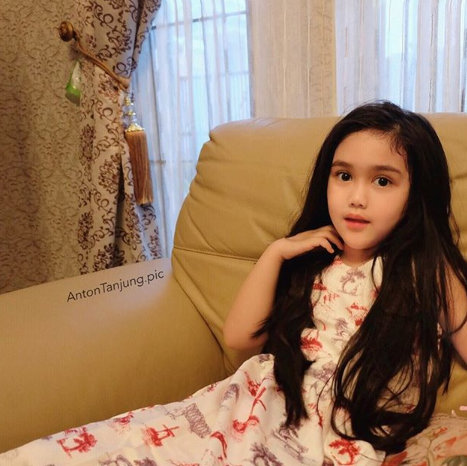 Manisnya Anin, Adik Dokter Anton Tanjung yang Hidungnya Super Mancung. Kecil-Kecil Udah Cantik!