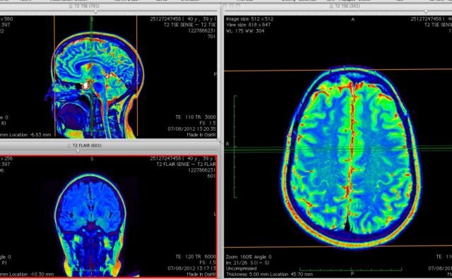 Hasilnya Sama-Sama Mirip Foto Klise hitam Putih, ini Bedanya X-Ray, CT Scan, dan MRI