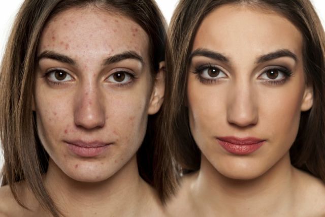 Masih Bingung Pilih BB Cream atau Foundation? Sekilas Terlihat Sama, Pahami Dulu Yuk Perbedaannya