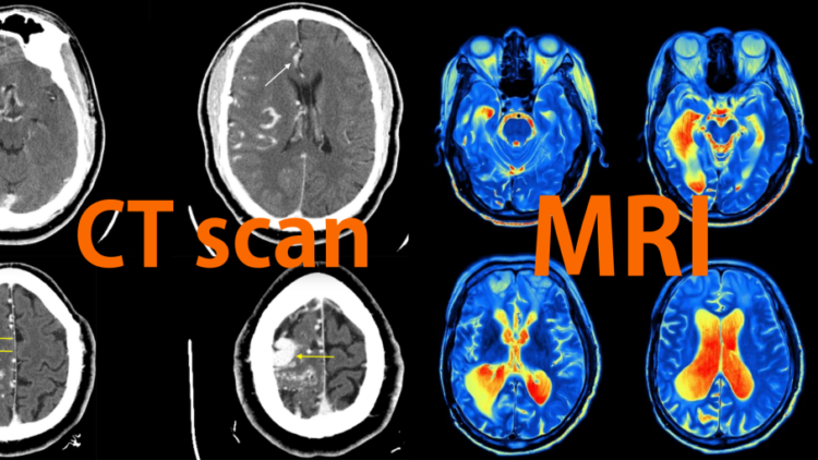 Hasilnya Sama-Sama Mirip Foto Klise hitam Putih, ini Bedanya X-Ray, CT Scan, dan MRI