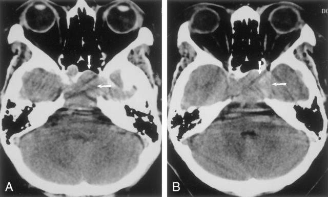 Hasilnya Sama-Sama Mirip Foto Klise hitam Putih, ini Bedanya X-Ray, CT Scan, dan MRI