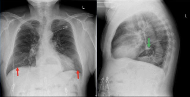 Hasilnya Sama-Sama Mirip Foto Klise hitam Putih, ini Bedanya X-Ray, CT Scan, dan MRI