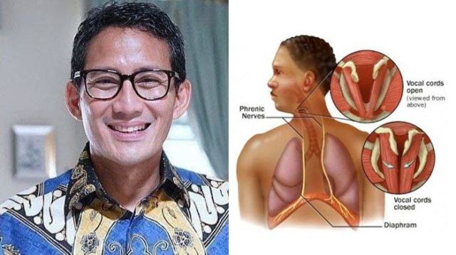 Sandiaga Uno Belakangan Jarang Muncul dan Terlihat Pucat, Seperti Apa Kondisi Kesehatannya?