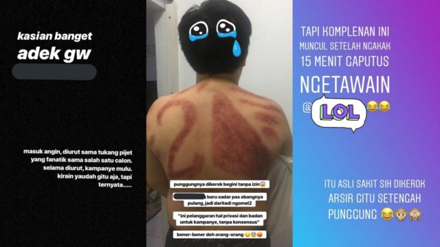 Dikerokin Tukang Urut, Punggung Pria ini Diarsir Nomor Urut Capres. Kocak, Dikira Baliho Kali~