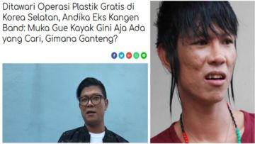 Selain Karena PD, Mungkin 7+ Motivasi ini Bikin Andika Babang Tamvan Tolak Oplas Gratis. Bebas dong!