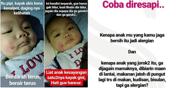 Viral! Ayah Curhat tentang Anaknya yang ‘Dicubit’ Hingga Sakit Kulit. Simak Dulu Nih Penjelasan Dokter