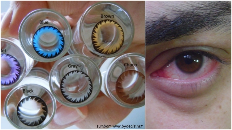 Remaja Nyaris Buta Akibat Softlens Abal-Abal. Patuhi 6 Hal ini Sebelum Beli Lensa Kontak!