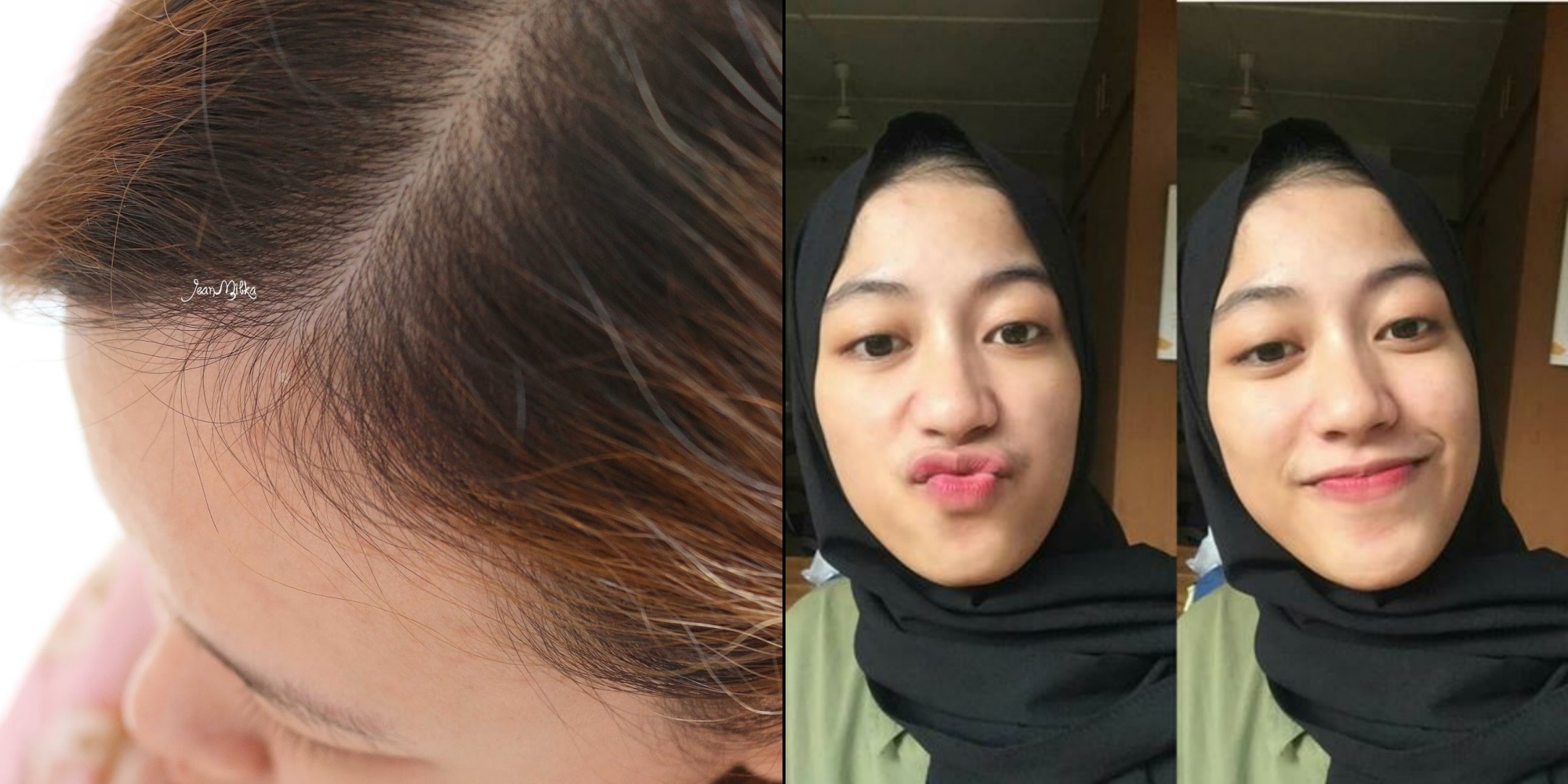 5 Cara Alami Hilangkan Anak Rambut di Dahi yang Suka Berdiri, Biar Tampilan Jadi Lebih Rapi