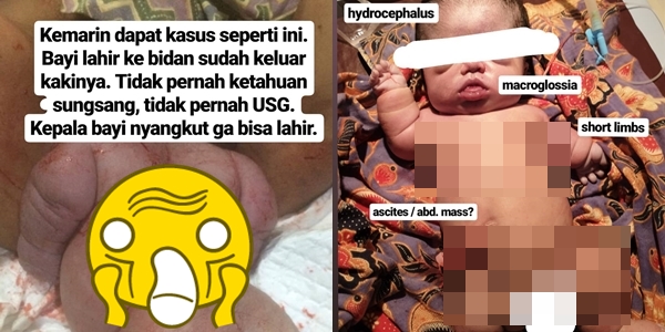 Viral Unggahan Ginekolog Darrell Fernando tentang Calon Ibu Tak Pernah USG, Dampaknya Bikin Ngeri!