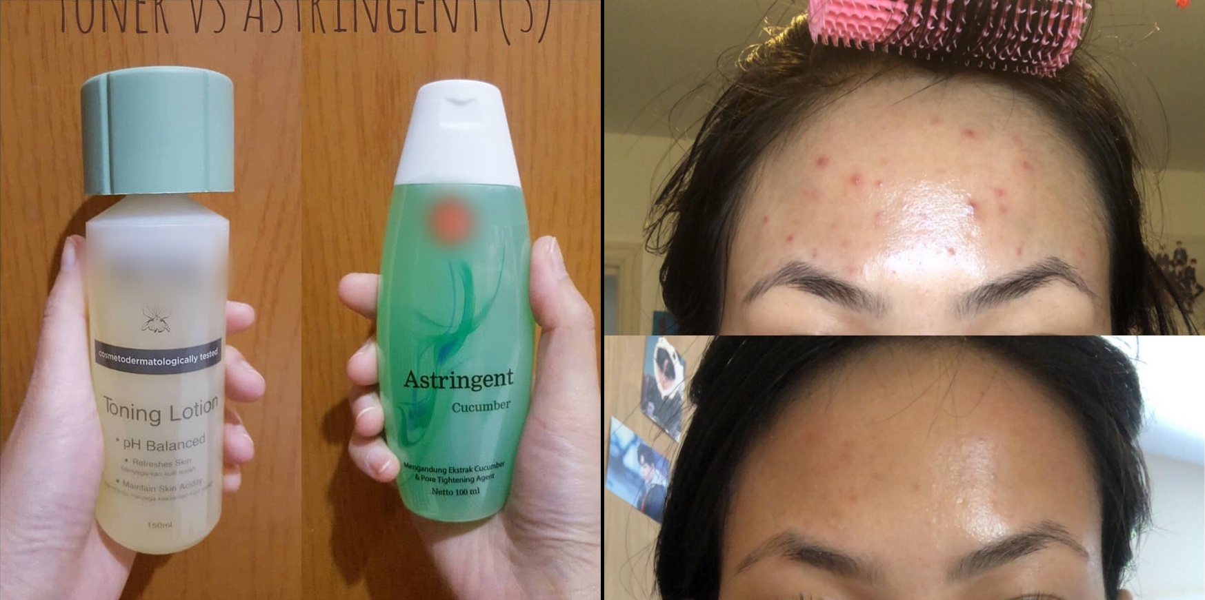 Perbedaan Toner dan Astringent dari Kandungan dan Penggunaannya