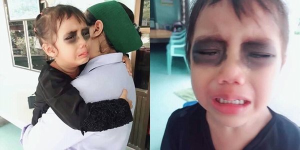 Viral Ibu Poles Make-up Hitam ke Mata Anak Demi Kapok Main Gadget, Ketahui Juga 6 Trik Lain Ini!