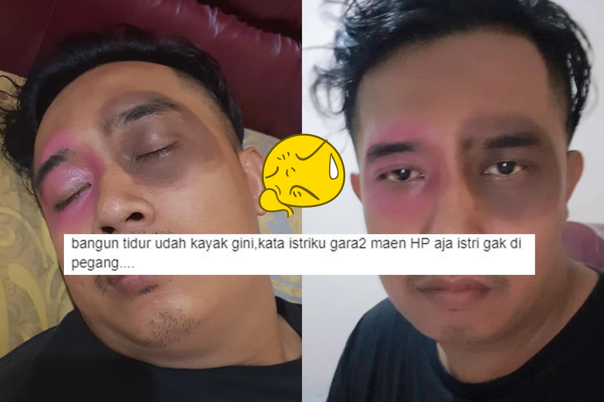 Suami Curhat Matanya Dibikin Hitam oleh Istri Karena Main HP Terus. Bukannya Jera, Malah Bikin Ketawa