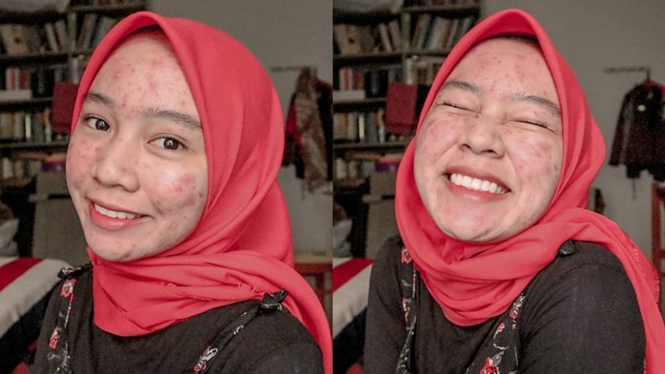 Dapat Perundungan karena Kisahnya, Novi si Hijabers Inspiratif Buktikan Usahanya Selama Ini