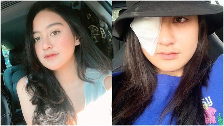 5 Tahun Gunakan Softlens, Mata Salshabilla Adriani Hampir Buta. Pelajaran untuk Kita Juga, nih