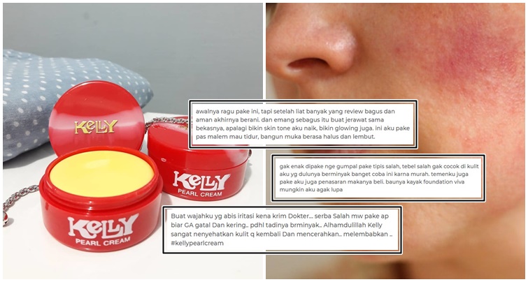 Pro-Kontra Krim Kelly yang Katanya Bahaya. Masalahnya, Masih Banyak yang Suka!