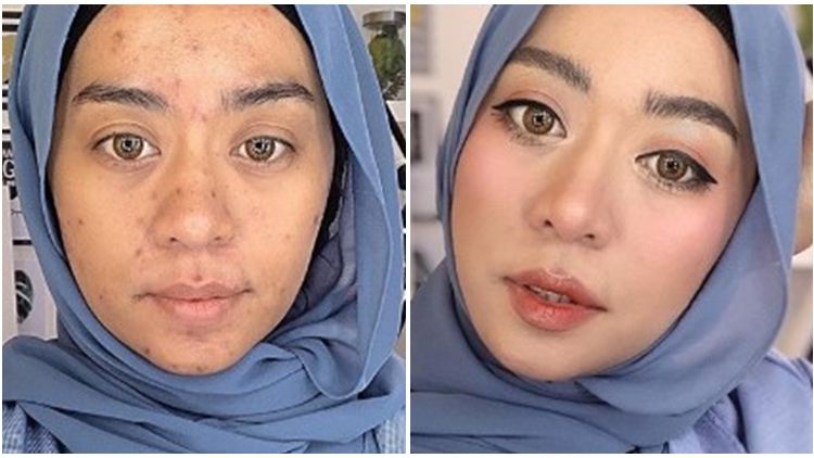 Bermodal Makeup Lokal Murah, Ini Rahasia Para Beauty Vlogger Menyamarkan Bekas Jerawat Mereka!