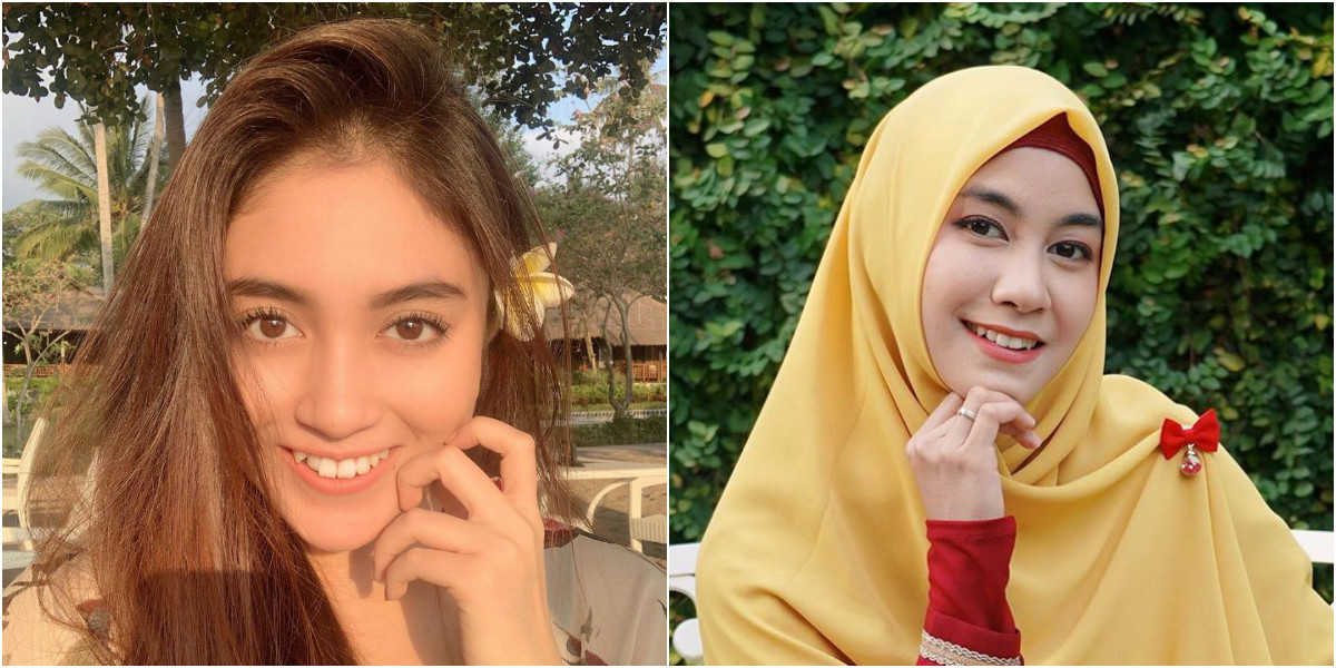 Tetap Pede Bahkan Kelihatan Lebih Manis, Ini Dia 8 Artis yang Bergigi Gingsul. Senyumnya itu loh~