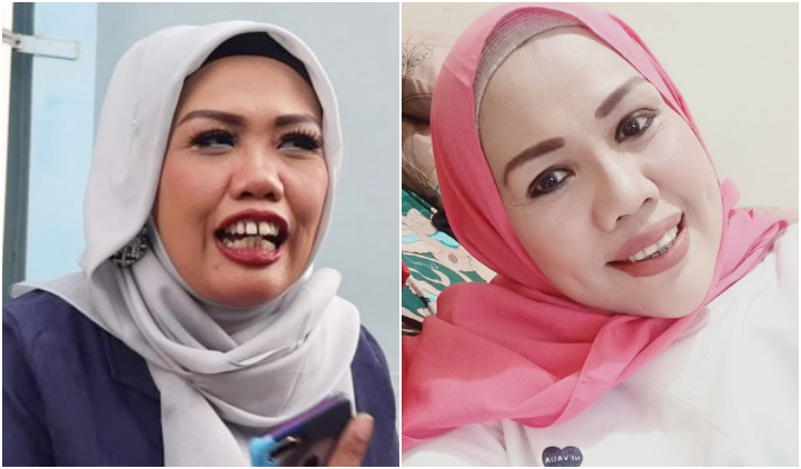 Mengaku Udah Bisa Mingkem, Elly Sugigi Pasang Behel Setelah Potong Gigi. Makin Percaya Diri