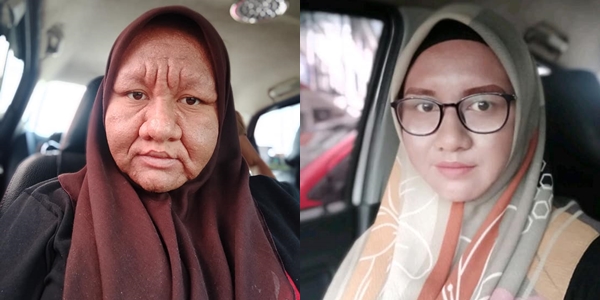 Viral Unggahan Wajah Bumil Bengkak hingga Tak Dikenali. Yuk Ketahui Penyebab dan Cara Mengatasinya!