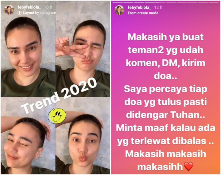 Lakukan Kemoterapi, Feby Febiola Pede dengan Rambut Cepak. Franky Sihombing Beri Pesan Romantis