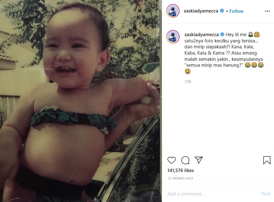 Posting Foto Waktu Bayi Biar Dibilang Mirip Anak, Zaskia Mecca Malah Lebih Mirip Keponakannya