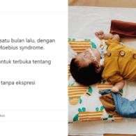 Kisah Hiro; si Kecil Pahlawan Moebius Syndrome, Penyakit Tanpa Ekspresi yang Berdampak Fatal