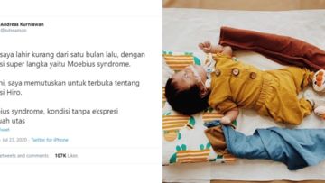 Kisah Hiro; si Kecil Pahlawan Moebius Syndrome, Penyakit Tanpa Ekspresi yang Berdampak Fatal