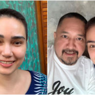 Lakukan Kemoterapi, Feby Febiola Pede dengan Rambut Cepak. Franky Sihombing Beri Pesan Romantis