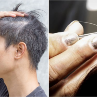 7 Mitos dan Fakta Tentang Rambut Uban. Memangnya Kalau Dicabut, Tumbuhnya Jadi Banyakan?