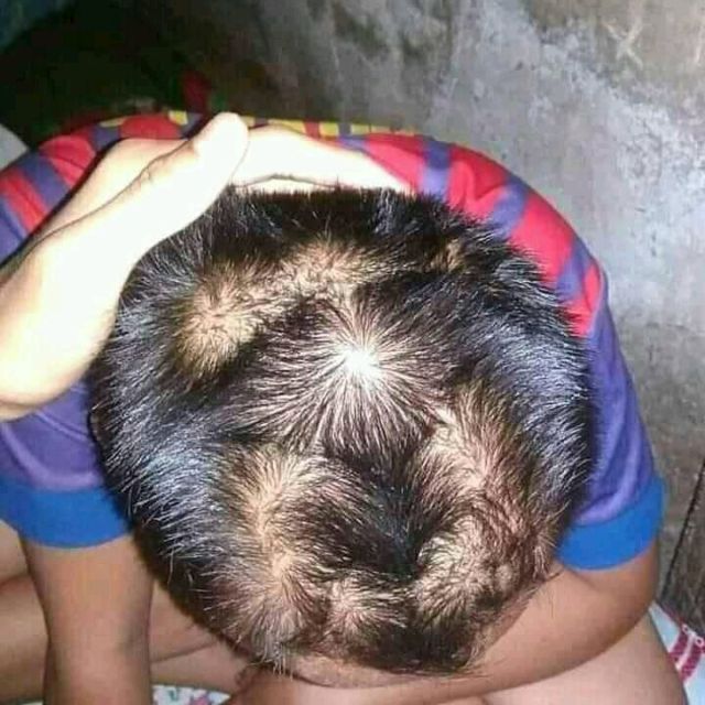 Anggapan Absurd Bocah dengan Jumlah Pusar Rambut Lebih dari Dua. Katanya Aktif Banget, Bun~